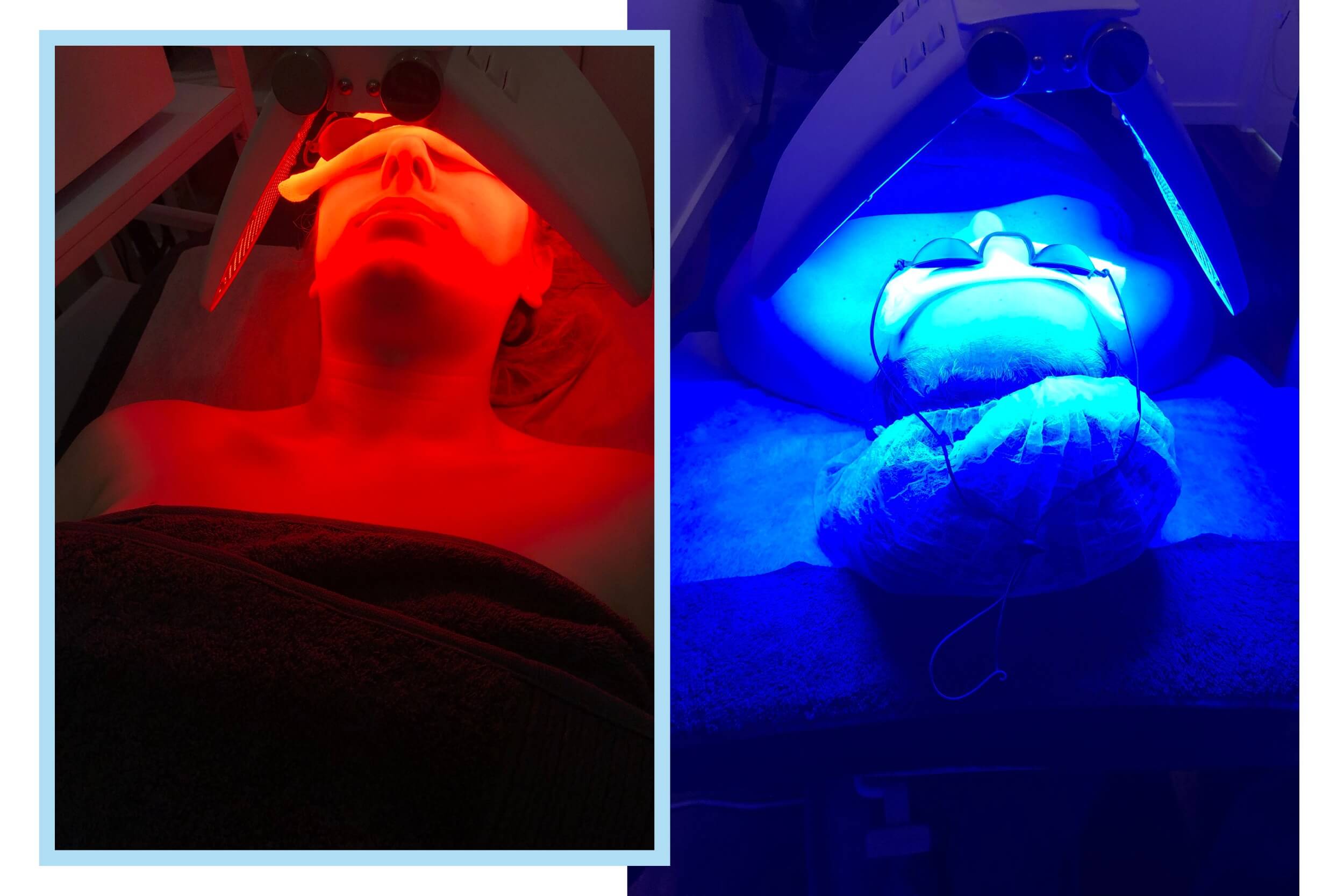 Treatments at Adelaide Laser Skincare